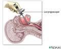 laryngoscopy1.jpg